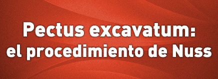 Pectus excavatum: el procedimiento de Nuss